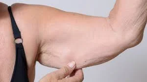 Sarcopenia Dr Navas Sarcopenia Dr Navas